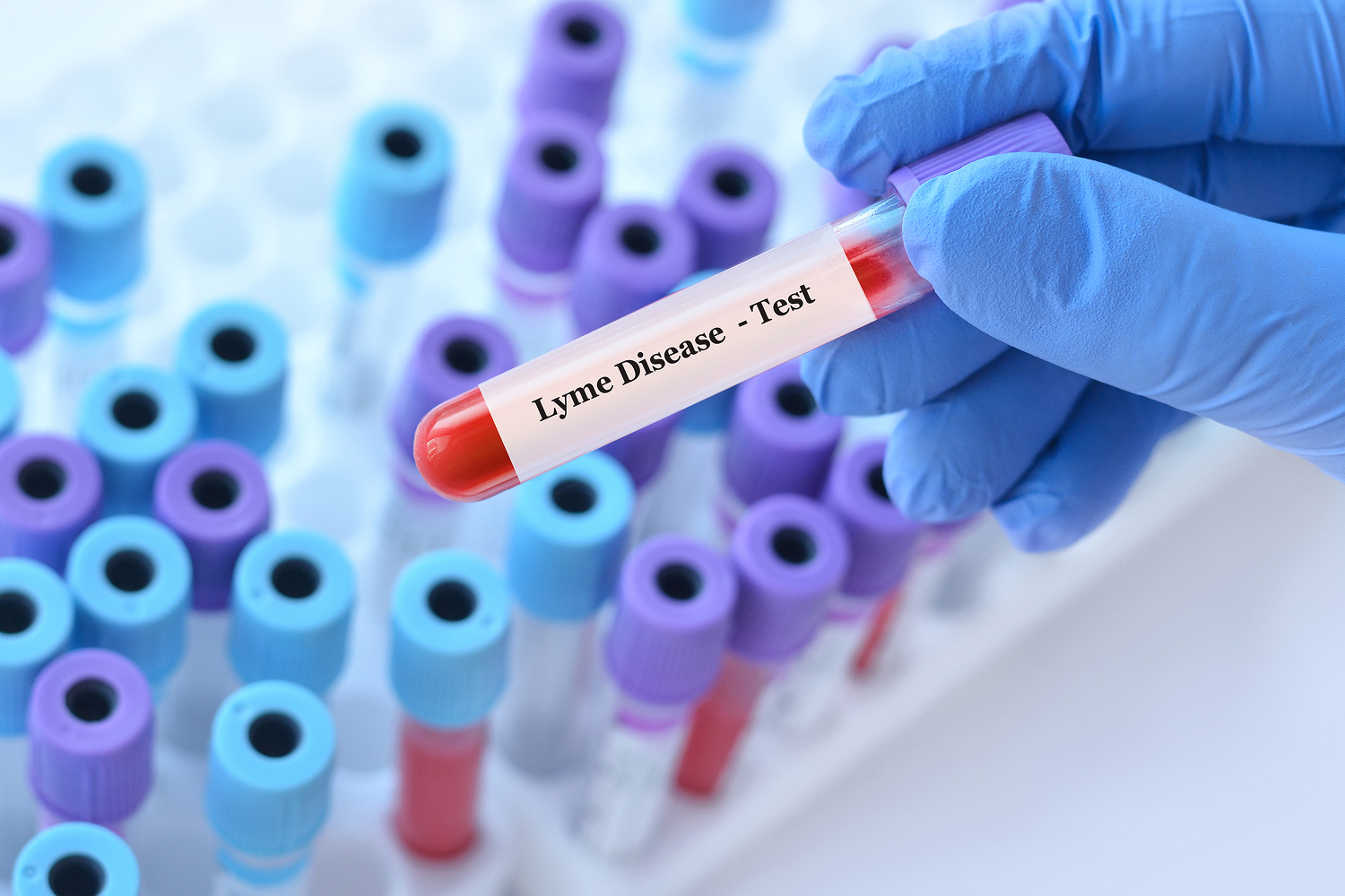 test tubes being used to detect lyme disease