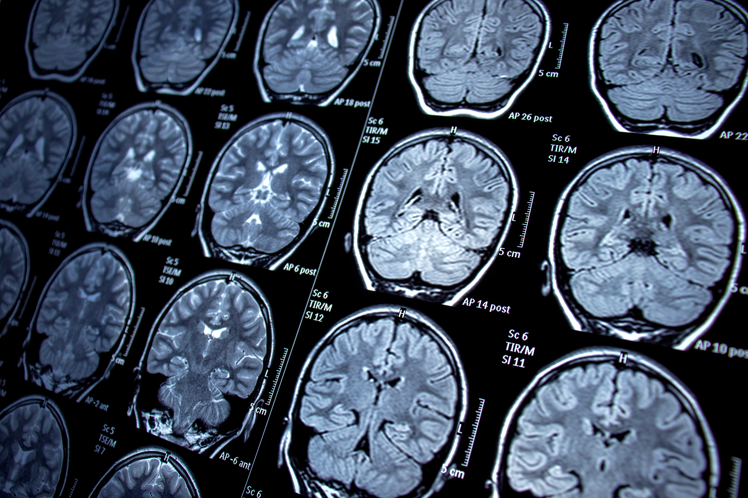 Many brain scans on a screen